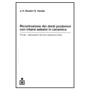 Ricostruzione dei denti posteriori con intarsi adesivi in ceramica - Principi, realizzazione, tecnica e procedura clinica