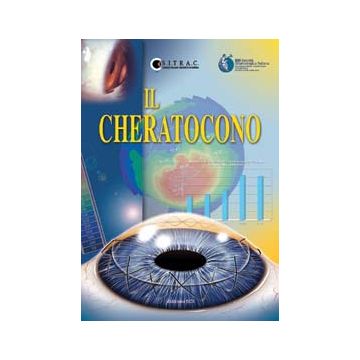 Il Cheratocono - Rapporto SOI 2004
