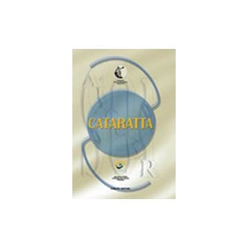 Cataratta - Rapporto SOI 1999