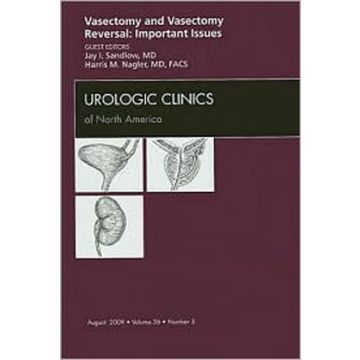 Vasectomy and Vasectomy Reversal: Important Issues, An Issue of Urologic Clinics Volume 36-3