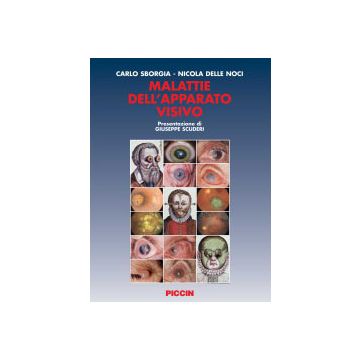 Malattie dell'Apparato Visivo [Carlo Sborgia; Nicola Delle Noci - Piccin Editore]