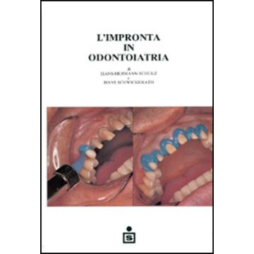 L' impronta in odontoiatria