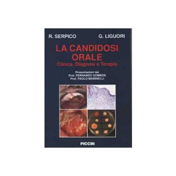 La Candidosi Orale.Testo Atlante.