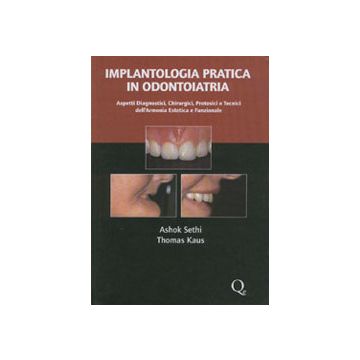 IMPLANTOLOGIA PRATICA IN ODONTOIATRIA - Aspetti diagnostici - chirurgici - protesici e tecnici dell' armonia estetica e funzionale