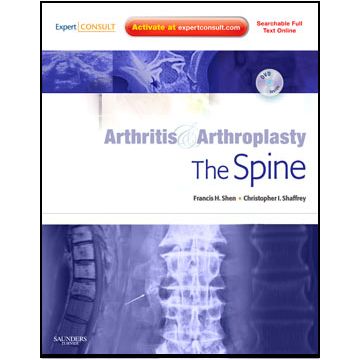 Arthritis and Arthroplasty: The Spine - Expert Consult - Online, Print and DVD