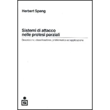 Sistemi di attacco nelle protesi parziali - Descrizione, classificazione, problematica ed applicazione