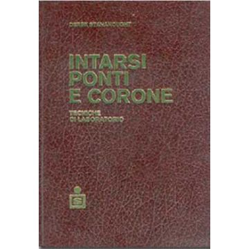 Intarsi, ponti e corone - Tecniche di laboratorio