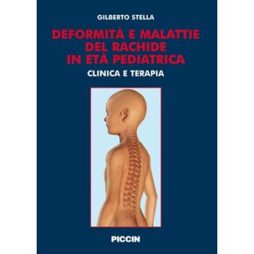 Deformità e malattie del rachide in età pediatrica