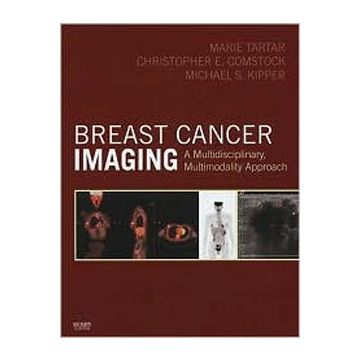 Breast Cancer Imaging -Breast Cancer Imaging