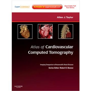 Atlas of Cardiovascular Computed Tomography: Expert Consult  - Online and Print