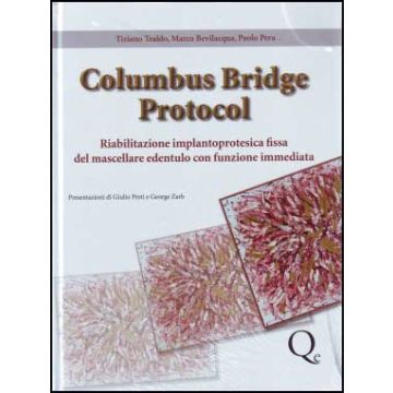 Columbus Bridge Protocol - Riabilitazione Implantoprotesica Fissa del mascellare edentulo con funzione immediata + DVD