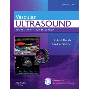 Vascular Ultrasound, 3rd Edition - How, Why and When