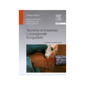 Tecniche di Anestesia Locoregionale Ecoguidate