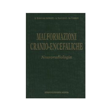 Malformazioni cranio-encefaliche.  Neuroradiologia
