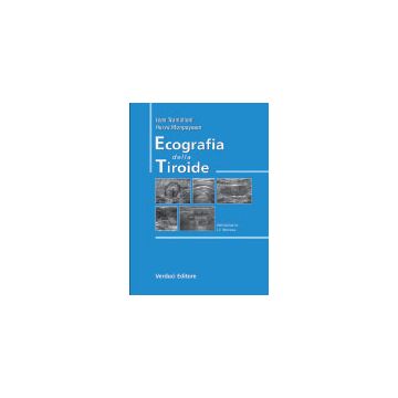 Ecografia della Tiroide  [Tramalloni - Verduci Editore]
