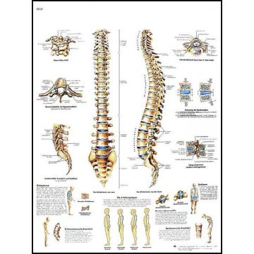 POSTER - La colonna vertebrale, anatomia e patologia (Laminata)