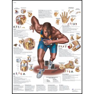 POSTER - Lesioni in seguito ad attività sportiva