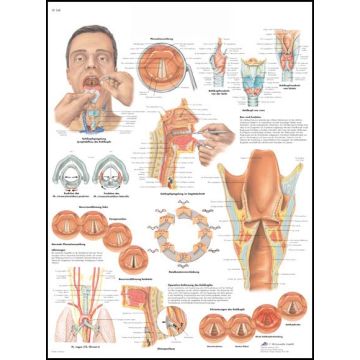 POSTER - La Laringe (Laminata)