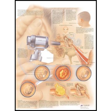 POSTER - Malattie dell