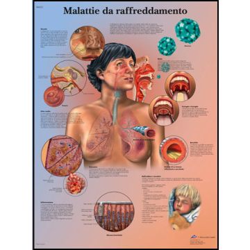 POSTER - Malattie da raffreddamento (Laminata)