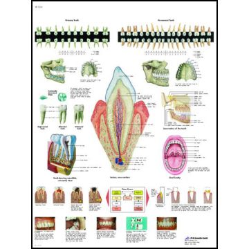 POSTER - La dentatura (Laminata)
