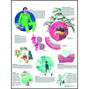 POSTER - Asma (Laminata)