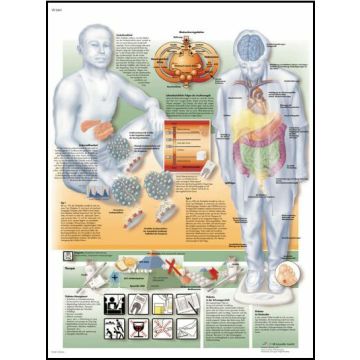 POSTER - Diabete mellito (Laminata)