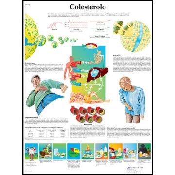 POSTER - Colesterolo (Laminata)