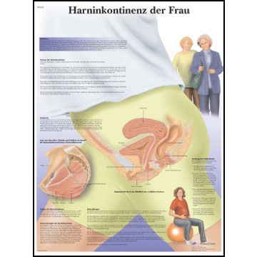 POSTER - Incontinenza urinaria femminile (Laminata)
