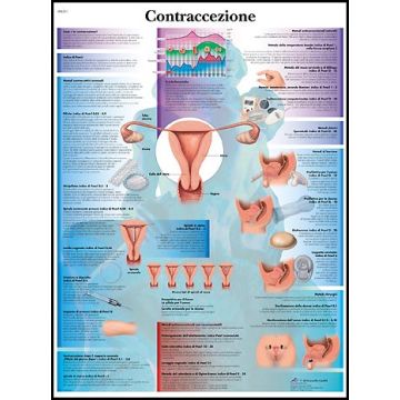 POSTER - TA Contraccezione (Laminata)