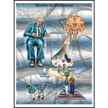 POSTER - Morbo di Parkinson (Laminata)