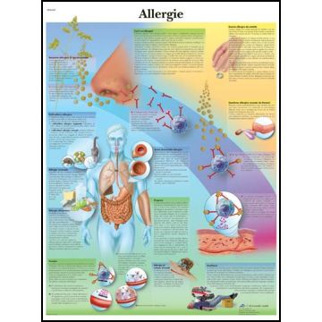 POSTER - Allergie (Laminata)