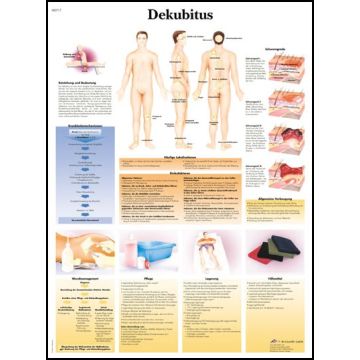 POSTER - Piaghe da decubito (Laminata)