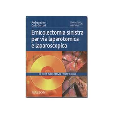 Emicolectomia sinistra per via laparotomica e laparoscopica (CD Interattivo)