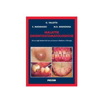 Malattie Odontostomatologiche