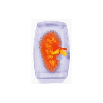 Modello dei vasi renali (rosso-giallo)
