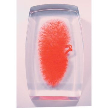 Modello dei vasi renali (rosso)