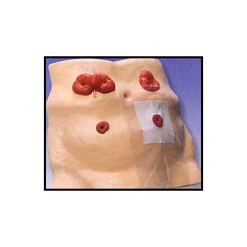 ASSISTENZA AL MALATO - Simulatore per stoma
