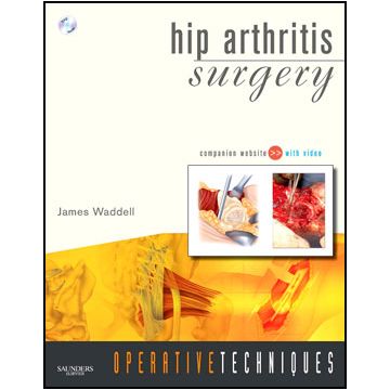 Operative Techniques: Hip Arthritis Surgery - Book, Website and DVD