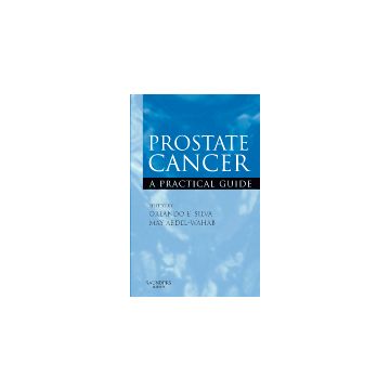Prostate Cancer - A Practical Guide