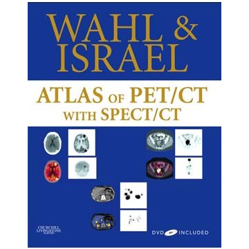 Atlas of PET/CT with SPECT / CT with DVD