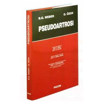 Pseudoartrosi