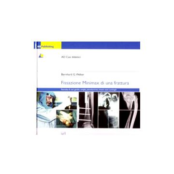 FISSAZIONE MINIMAX DI UNA FRATTURA - AO Casi didattici