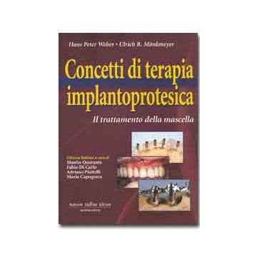 WEBER Concetti di Terapia Implantoprotesica Delfino Antonio Editore