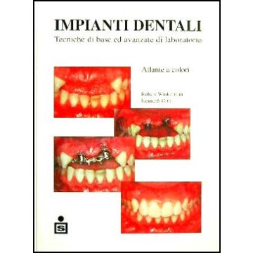 Impianti dentali - Atlante a colori - Tecniche di base ed avanzate di laboratorio