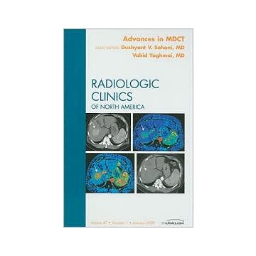 Advances in MDCT, An Issue of Radiologic Clinics Volume 47-1