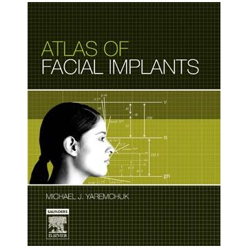Atlas of Facial Implants