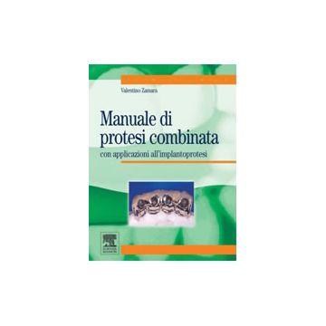 Manuale di protesi combinata con applicazioni all’ implantoprotesi  [Zamara  - Edra Elsevier Masson]