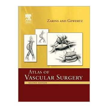 Atlas Of Vascular Surgery - Paperback Edition, 2nd Edition