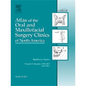 Mandibular Trauma, An Issue of Atlas of the Oral and Maxillofacial Surgery Clinics Volume 17-1